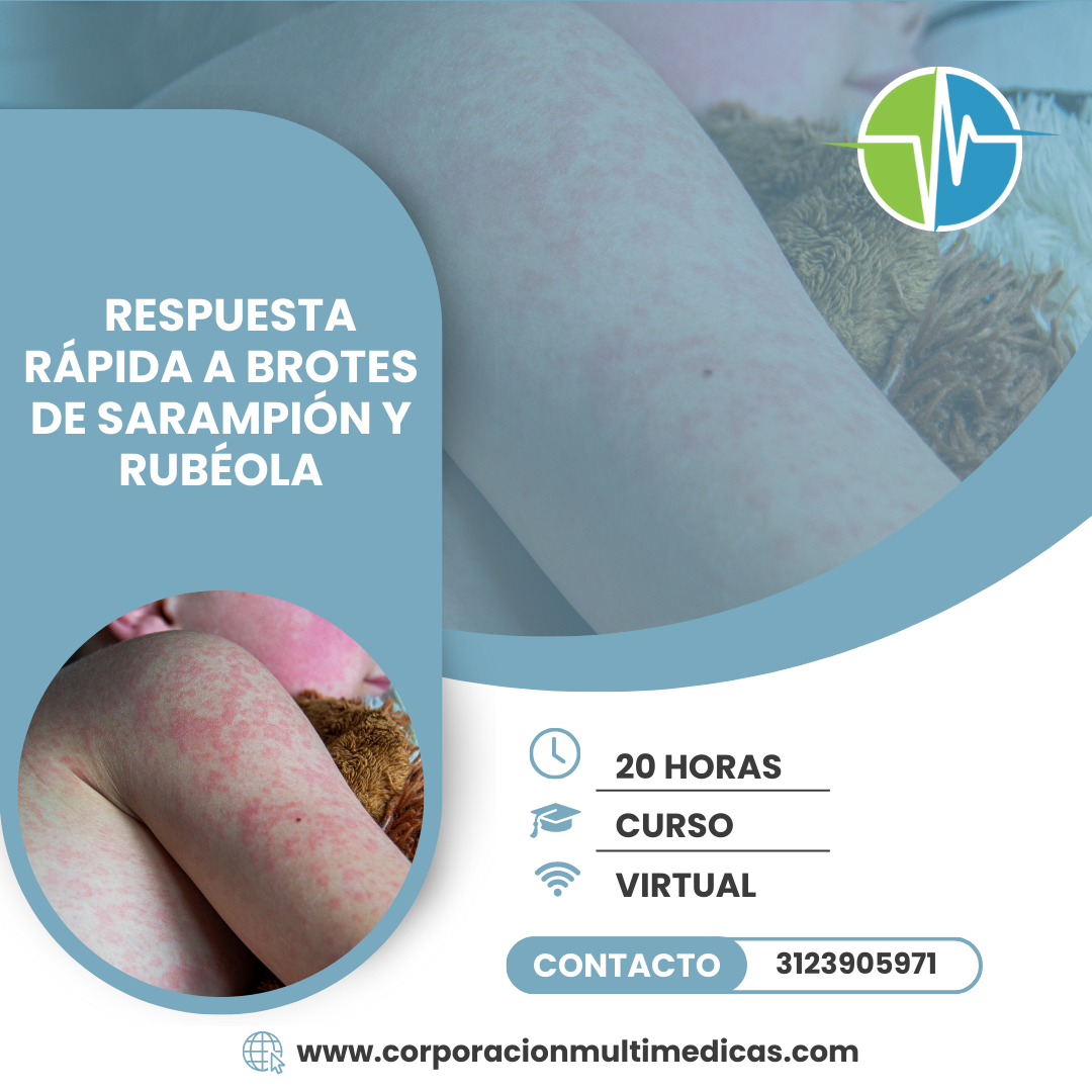 RESPUESTA RÁPIDA A BROTES DE SARAMPIÓN Y RUBÉOLA
